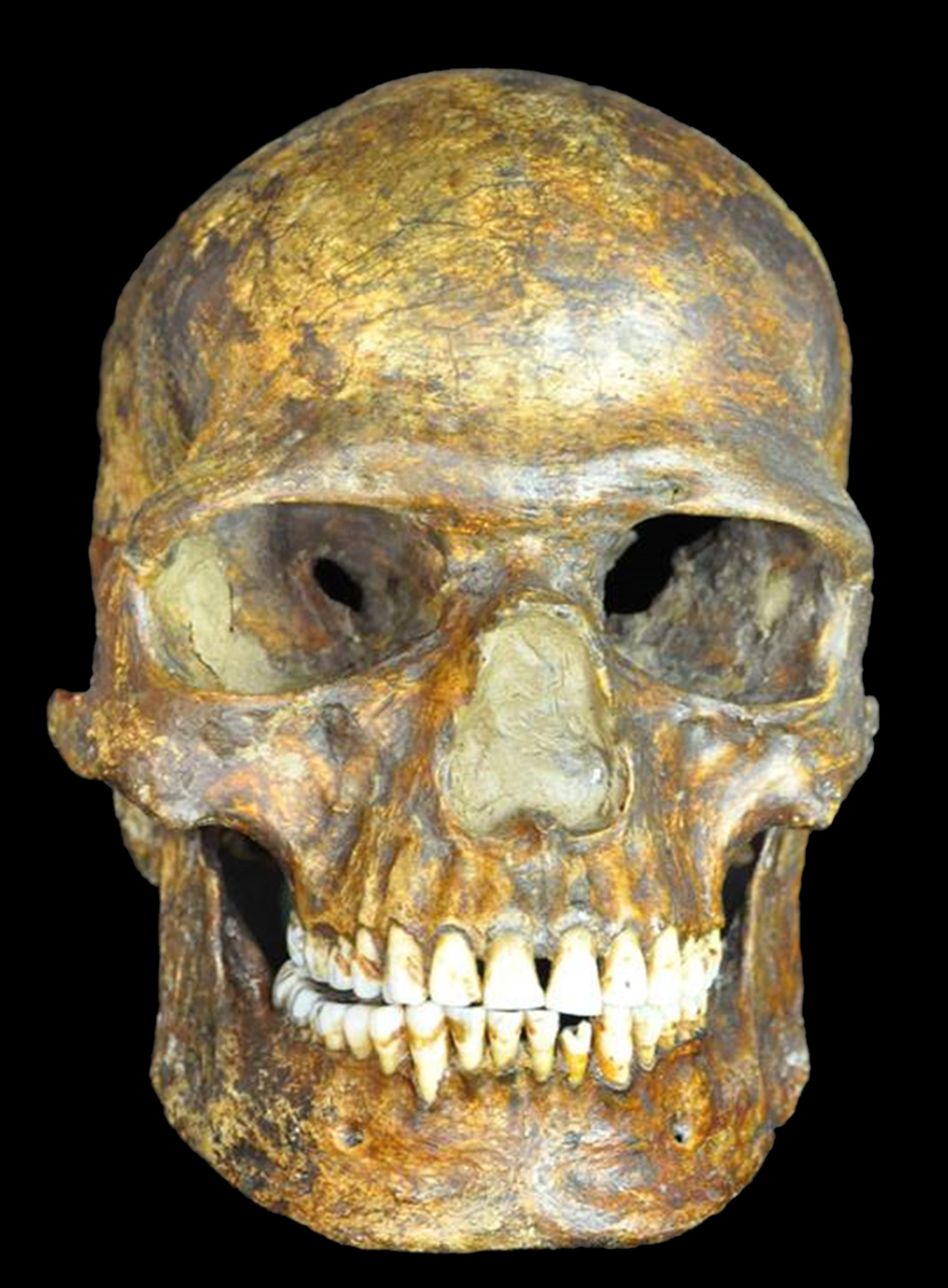 The fossil skull from Kostenki 14